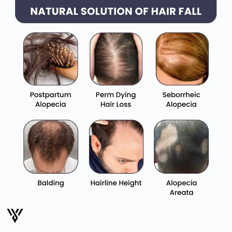 100% Pure Unrefined Batana Hair Oil (120ml, 1-bottle pack), presented as a natural solution for hair fall - VAYOME.