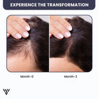 100% Pure Unrefined Batana Hair Oil (120ml, 1-bottle pack), showing a 2-month transformation from falling hair to growing hair - VAYOME.