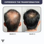 100% Pure Unrefined Batana Hair Oil (120ml, 1-bottle pack), showing a 2-month transformation from falling hair to growing hair - VAYOME.