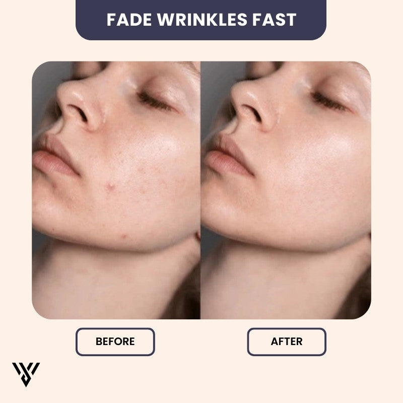 Hyaluronic Acid Serum (15ML), anti-aging and hydrating, before/after image illustrating fast fading of wrinkles - VAYOME.