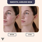 Hyaluronic Acid Serum (15ML), anti-aging and hydrating, before/after image for smooth, ageless skin results - VAYOME.