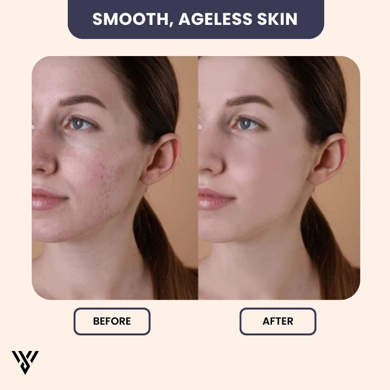 Hyaluronic Acid Serum (15ML), anti-aging and hydrating, before/after image for smooth, ageless skin results - VAYOME.